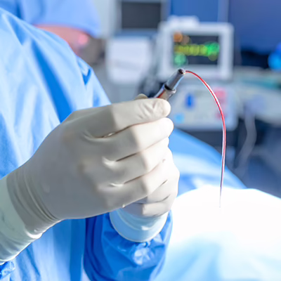 A surgeon holds an arterial guidewire before performing a minimally invasive arterial procedure.